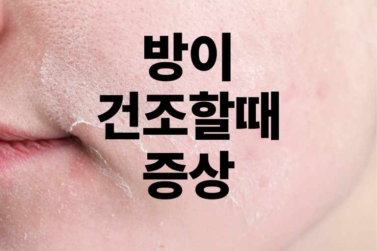 방이 건조할 때 증상